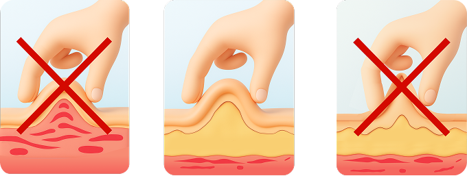 Техника инъекций инсулина